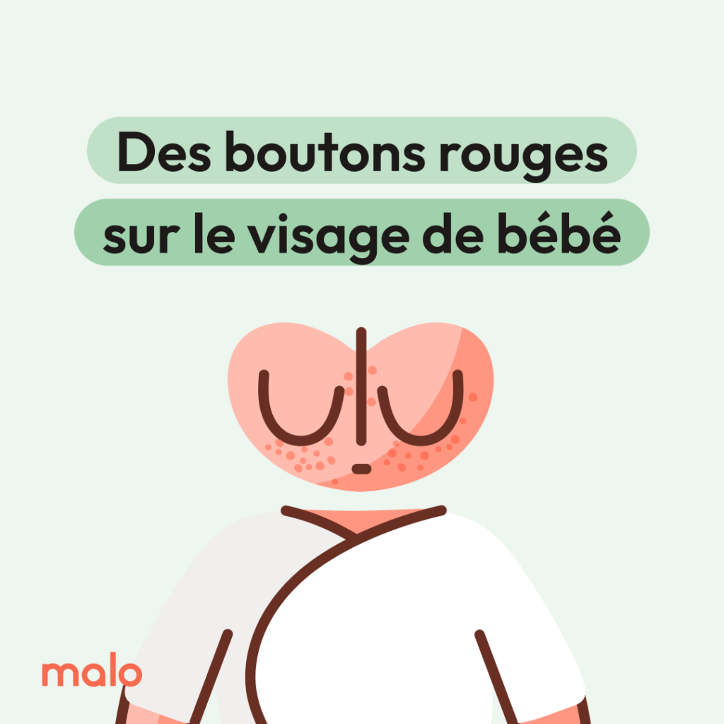 Boutons rouge sur le visage d'un nouveau-né, illustré par l'application Heloa