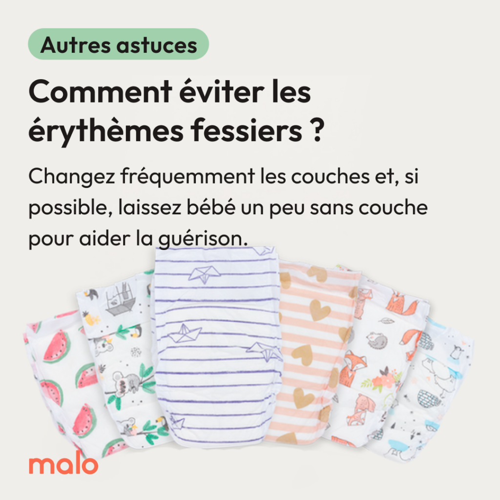 Conseils de Heloa pour éviter les érythèmes fessiers est de changer les couches régulièrement pour éviter les fesses rouges de bébé