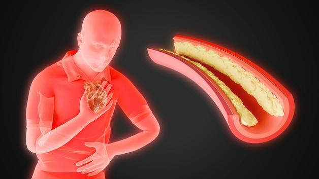 Illustration d'une femme enceinte se tenant le ventre, illustrant les brûlures estomac enceinte.