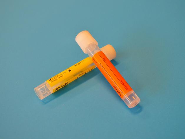 Échantillons de tests urinaires pour détecter la glycosurie grossesse et évaluer la santé maternelle.