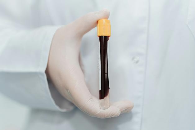 Un échantillon de sang en tube pour analyser la glycosurie grossesse chez les femmes enceintes.