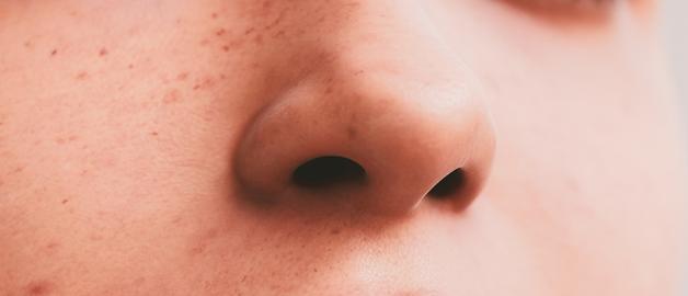 Détail du visage montrant des imperfections cutanées; un masque grossesse peut aider à améliorer la texture de la peau.