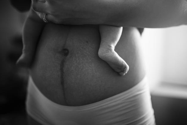 Image d'une femme tenant un bébé avec des vergetures grossesse visibles sur son ventre.